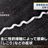 梅毒患者 今年４０００人超、５年で５倍に急増