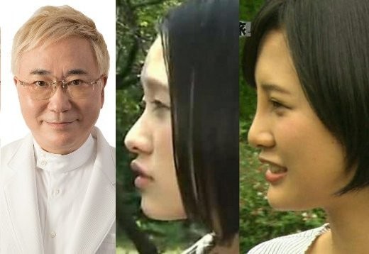 高須院長がHKT48兒玉遥の鼻筋にコメントｗ　「ヒアルロン酸の射ちすぎ」「ギリシャ人」「アバター」：コメント1