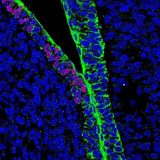 人類がついにキメラの生成に成功し人豚誕生！