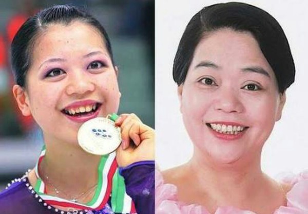 元フィギュアスケート選手の鈴木明子、拒食症の始まりはコーチの助言「1kg減らせば跳べる」：コメント2