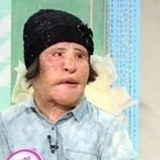 不法な整形手術の副作用に苦しみ 韓国の「扇風機おばさん」が死去