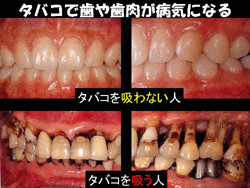 酒は煙草よりも害悪である。：コメント455