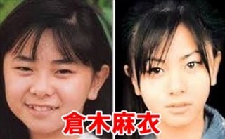 整形"してると思う"女性芸能人は？「顔が変わっていく様子」を女性は見抜いてるのか：コメント28