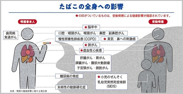 「ルール守っているのに、なぜ...」　過熱する「タバコ叩き」、喫煙者の本音は：コメント671