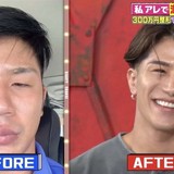 整形費用300万円で“岩田剛典似”に激変した男性登場 “やって良かった整形”告白